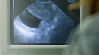 Slow husband and sneaky wife smart doctor